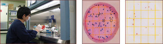 위생검사 이미지